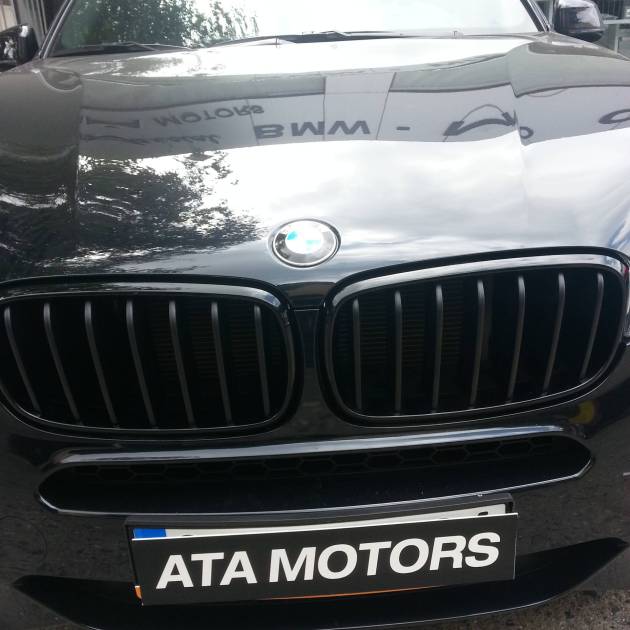 *** F15 M PERF. BÖBREK