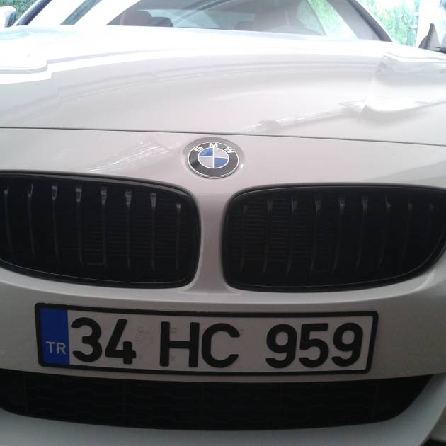 *** F33 M PERF. BÖBREK